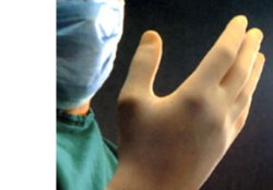 Guanto chirurgico sterile in lattice misura 8,5